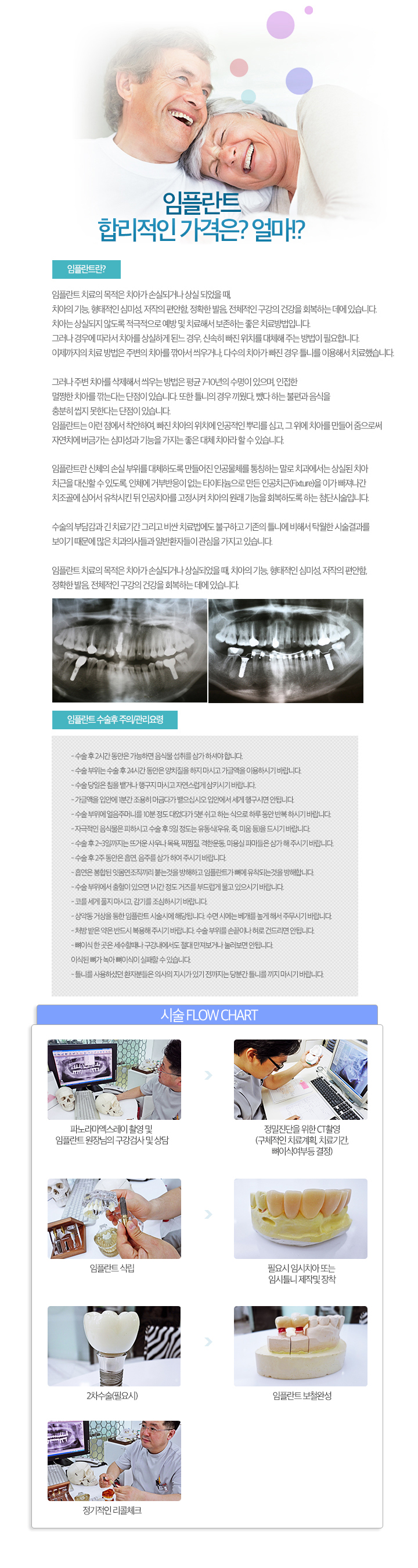 이젠 질긴음식도 문제없는 임플란트